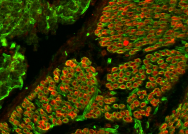 Why is it important to understand the mechanisms underlying disease?